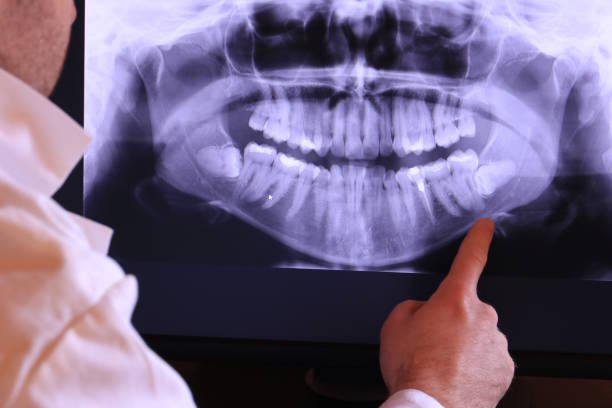 Best Emergency Dental Services for Seniors in Hallsville, MO