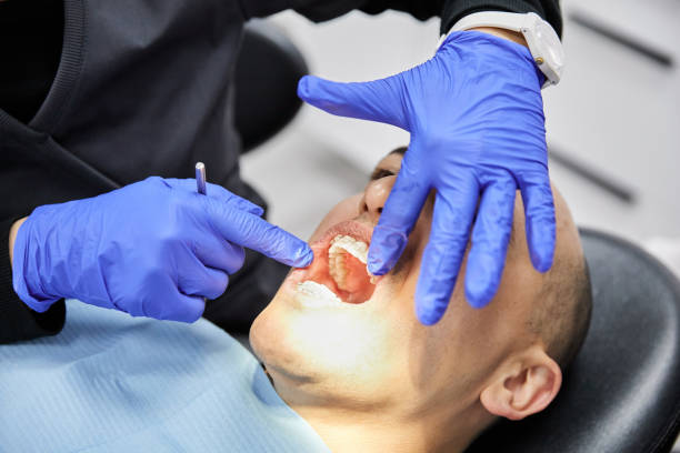Best Emergency Dental Care for Abscessed Tooth in Hallsville, MO