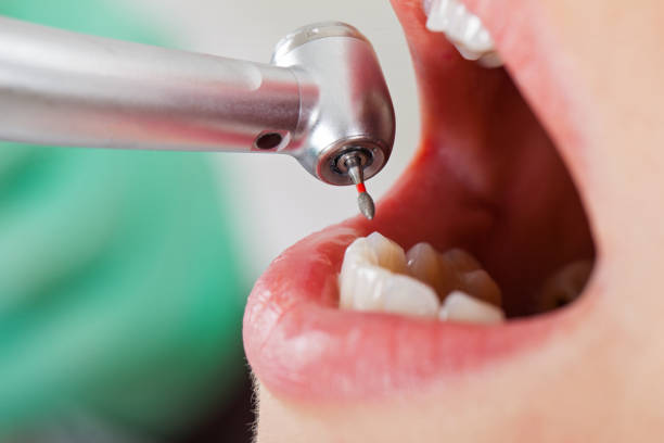 Best Emergency Dentist for Knocked-Out Tooth in Hallsville, MO